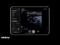 24 206 Mindray TE Air Tutorial iWorks