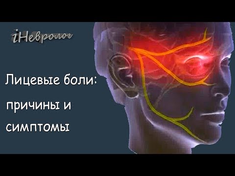 Болит лицо - не лечите самостоятельно! Советы опытного невролога.