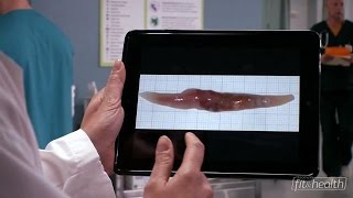 A Fraternitys Fluke Problem | Untold Stories of the ER