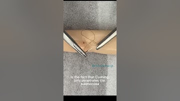 How to make Cushing/Connell suture pattern
