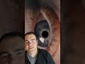 Open Eye