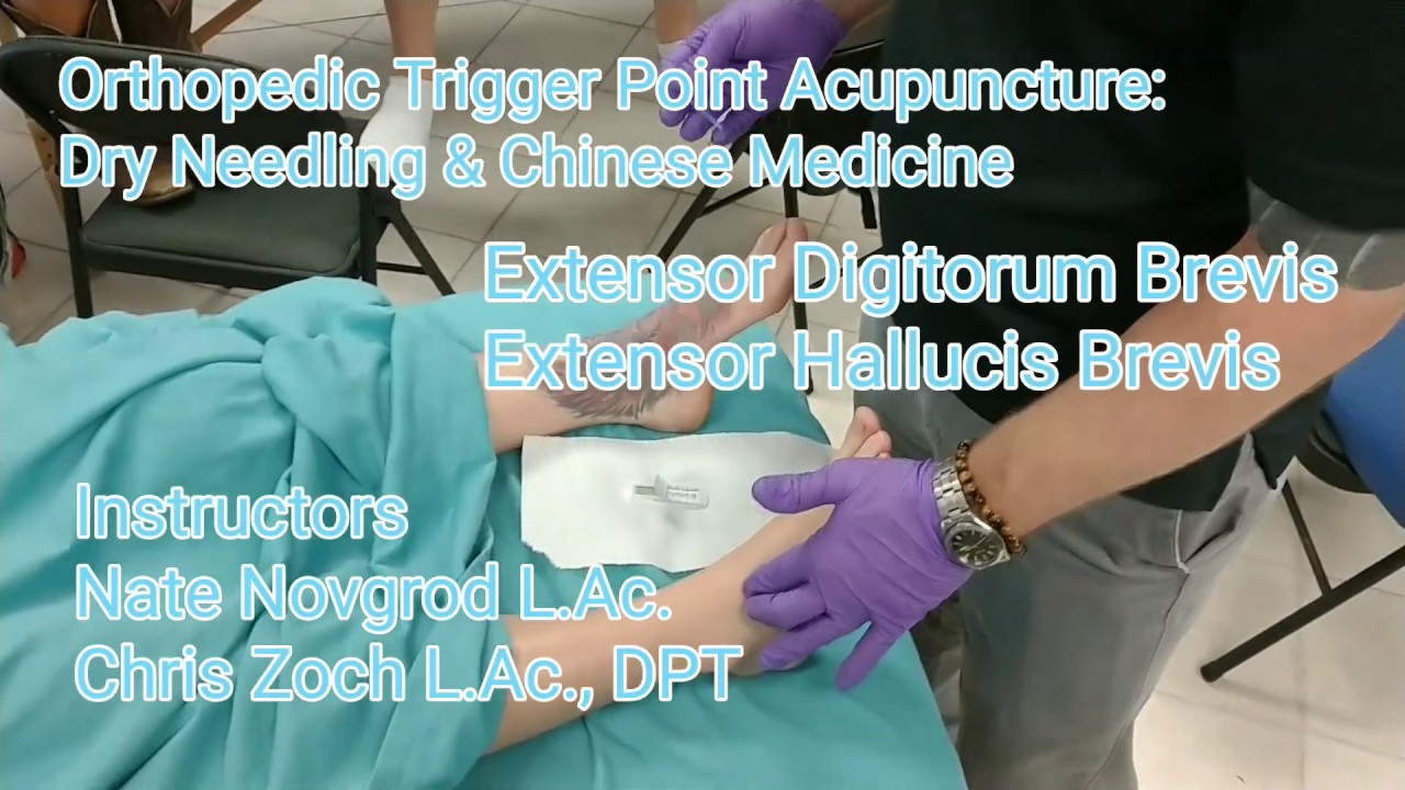 Orthopedic Trigger Point Acupuncture: Extensor Digitorum Brevis / Extensor Hallucis Brevis