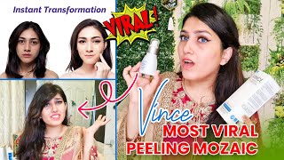 Vince Most Viral Peeling Mozaic | Serum For Face