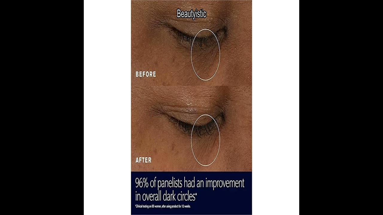 Обзор ночного восстанавливающего крема для кожи вокруг глаз Estée Lauder Advanced Night Repair: д...