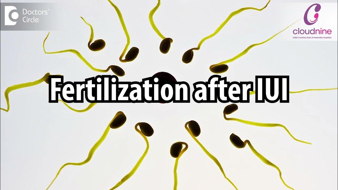 How long does it take for Fertilization after IUI ? I Dr. Veena Shinde