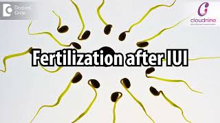 How long does it take for Fertilization after IUI ? I Dr. Veena Shinde I Cloudnine Hospital