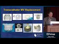 Transcatheter mitral valve replacement repair replace or do nothing