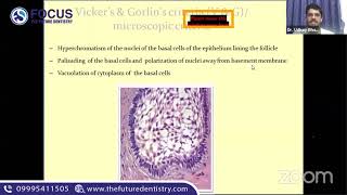 NEET MDS Entrance Coaching | AMELOBLASTOMA | NEET MDS | Oral pathology | FOCUS THE FUTUREDENTISTRY