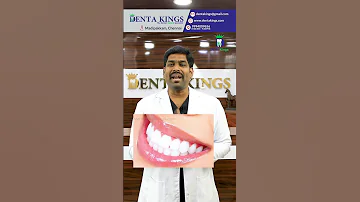 வெள்ளை நிற பற்கள் வேண்டுமா? How to get white teeth? Denta Kings Dr. Karthikeyan