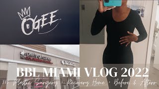 BBL MIAMI VLOG 2022 | 305 PLASTIC SURGERY + RECOVERY HOME + BEFORE AND AFTER