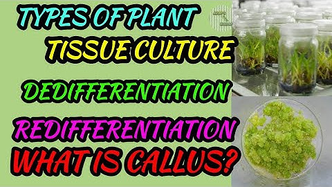 TYPES OF PLANT TISSUE CULTURE || DEDIFFERENTIATION || REDIFFERENTIATION || WHAT IS CALLUS?