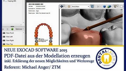 EXOCAD TUTORIAL - Neue EXOCAD SOFTWARE 2015 - PDF aus der Modellation erzeugen by Michael Anger