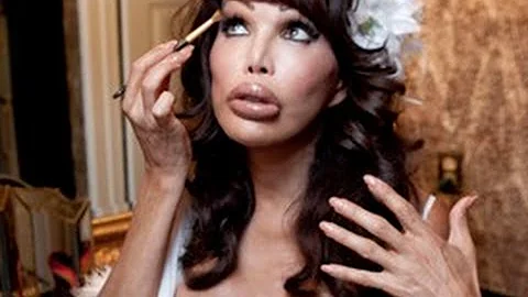 Psychology of Plastic Surgery