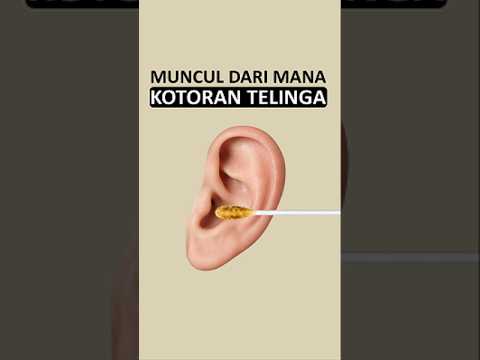 siapa yang suka ngorekin telinga? 😁✋