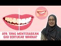 Apa yang Menyebabkan Gigi Bertukar Warna?