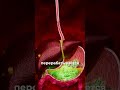 Вред от сахарозаменителей #trending #бады #витамины #медицина #здоровье #fyp