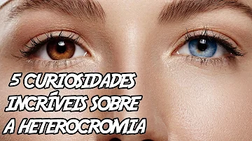 Qual a probabilidade de uma pessoa ter heterocromia?