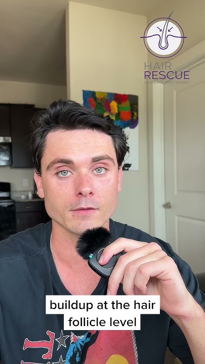 does-testosterone-cause-hair-loss-youtube