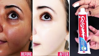 Natural Skin Bleaching Home Remedy । Toothpaste Skin Whitening Hacks