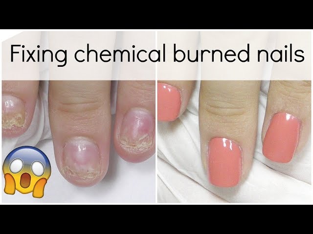 How to Fix Peeling Nails – glamnetic