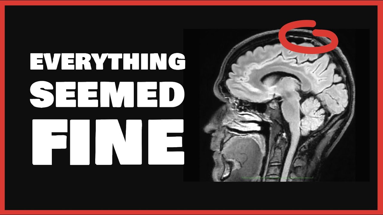 My Posture Nearly Killed Me… — Transcript