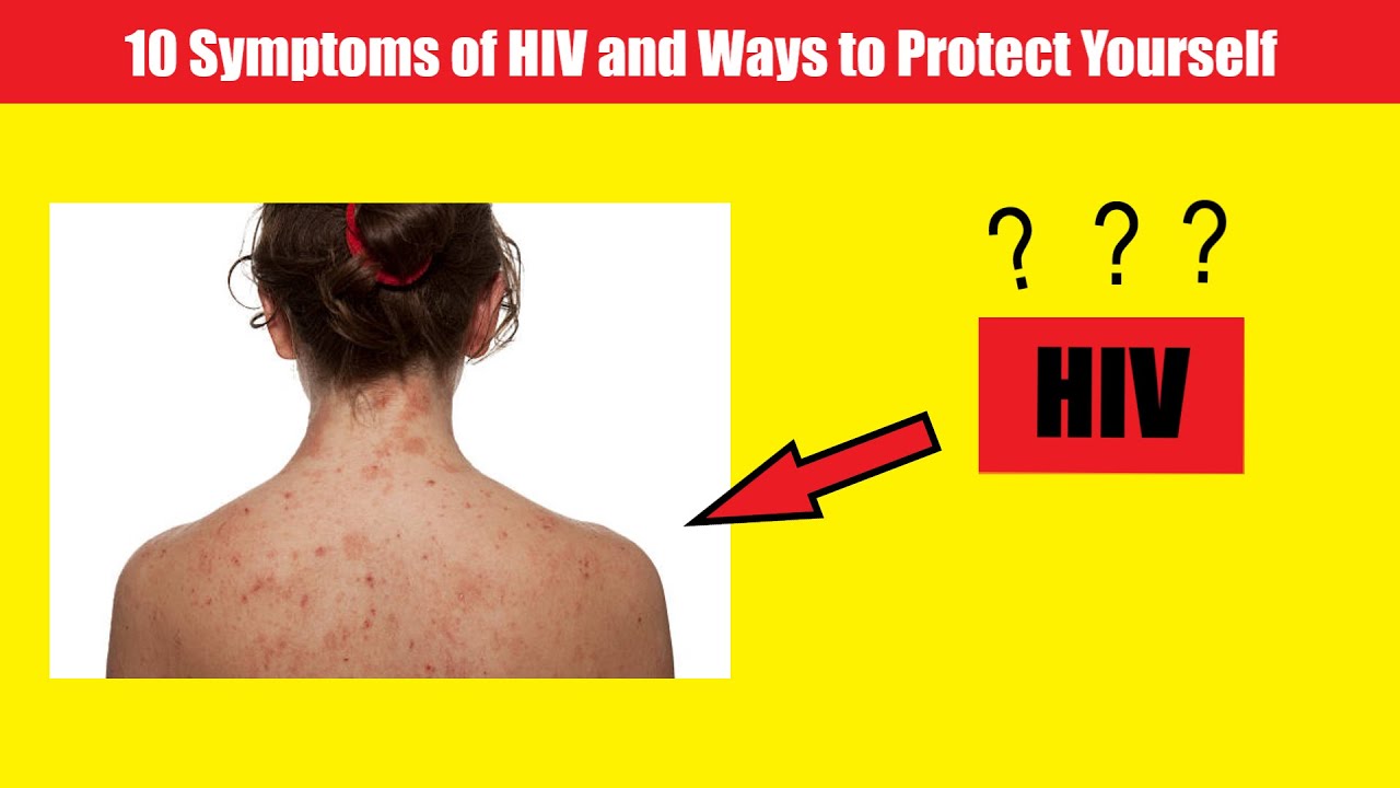 10 Symptoms of HIV and Ways to Protect Yourself - YouTube