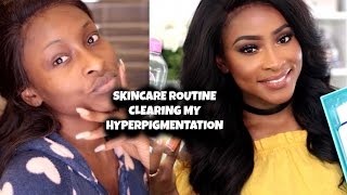 SKINCARE ROUTINE | HOW I CLEARED UP MY HYPERPIGMENTATION