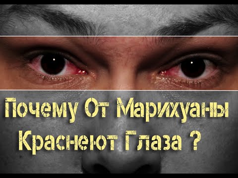 ПОЧЕМУ ОТ МАРИХУАНЫ КРАСНЕЮТ ГЛАЗА? И КАК ИЗБАВИТЬСЯ ОТ ЭТОГО ПОБОЧНОГО ЭФФЕКТА РАЗ И НАВСЕГДА!