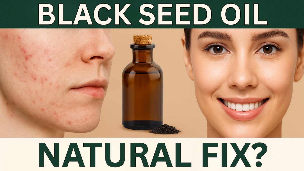 10 Proven Benefits of Black Seed Oil You Need to Know! # ...