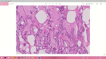 Stanford University Code in Place 2020_CT Scan Filter Final Project