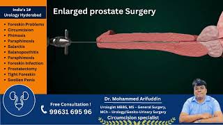Enlarged prostate surgery in Hydeabad | Enlarged prostate Treatment in Hyderabad #doctor #treatment