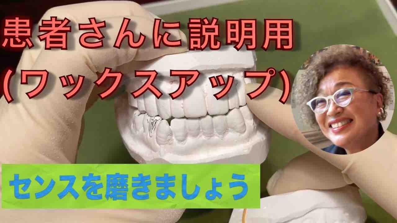 患者さんに説明用（ワックスアップ）