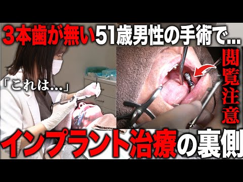 生涯歯を残せる時代の5つのスキル : 歯科疾患の掌握/主訴対応/生活歯治療/失… 生涯歯を残せる時代の5つのスキル (QUINT KICK-OFF LIBRARY
