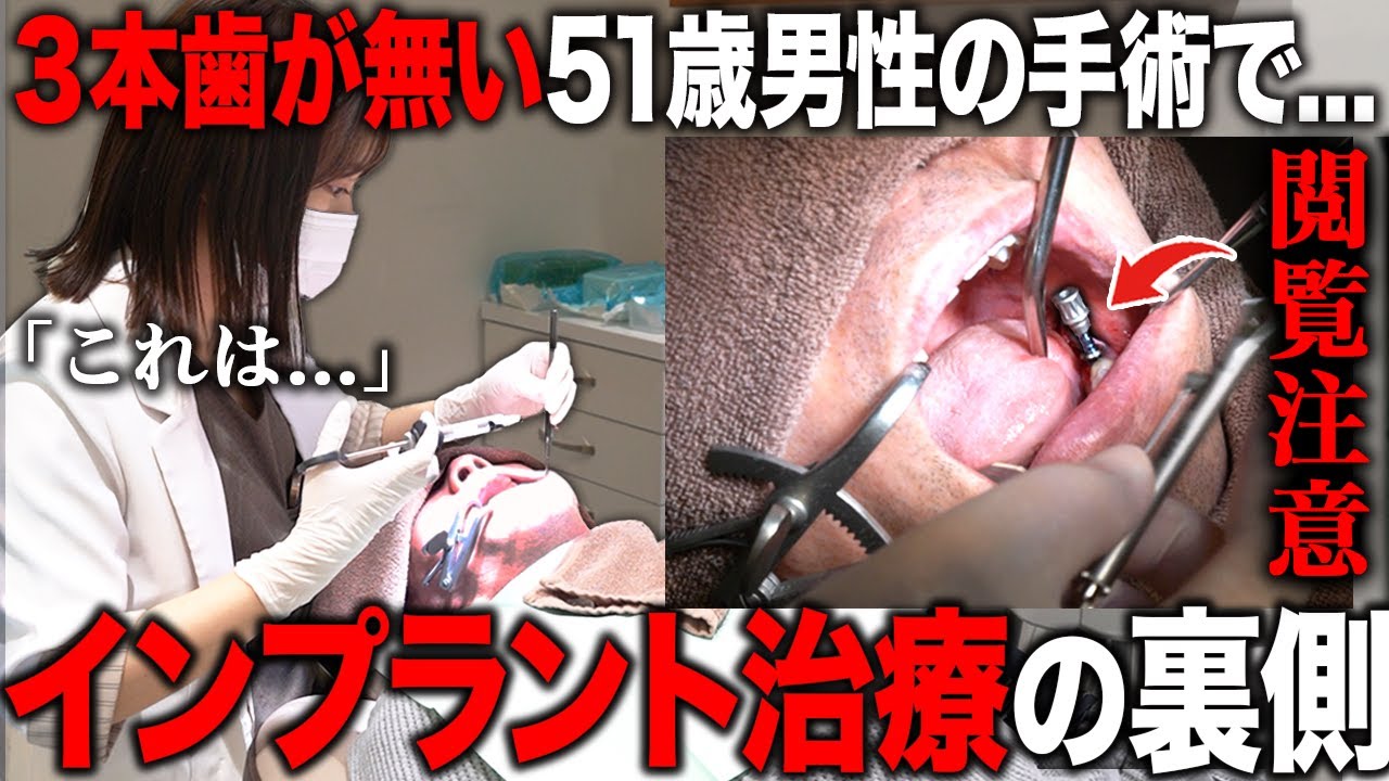 A must-see for those with dental phobia] Six-step treatment