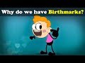 Why do we have Birthmarks? + more videos | #aumsum #kids #science #education #children