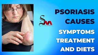 Psoriasis - Causes, Symptoms, Treatment and Diets