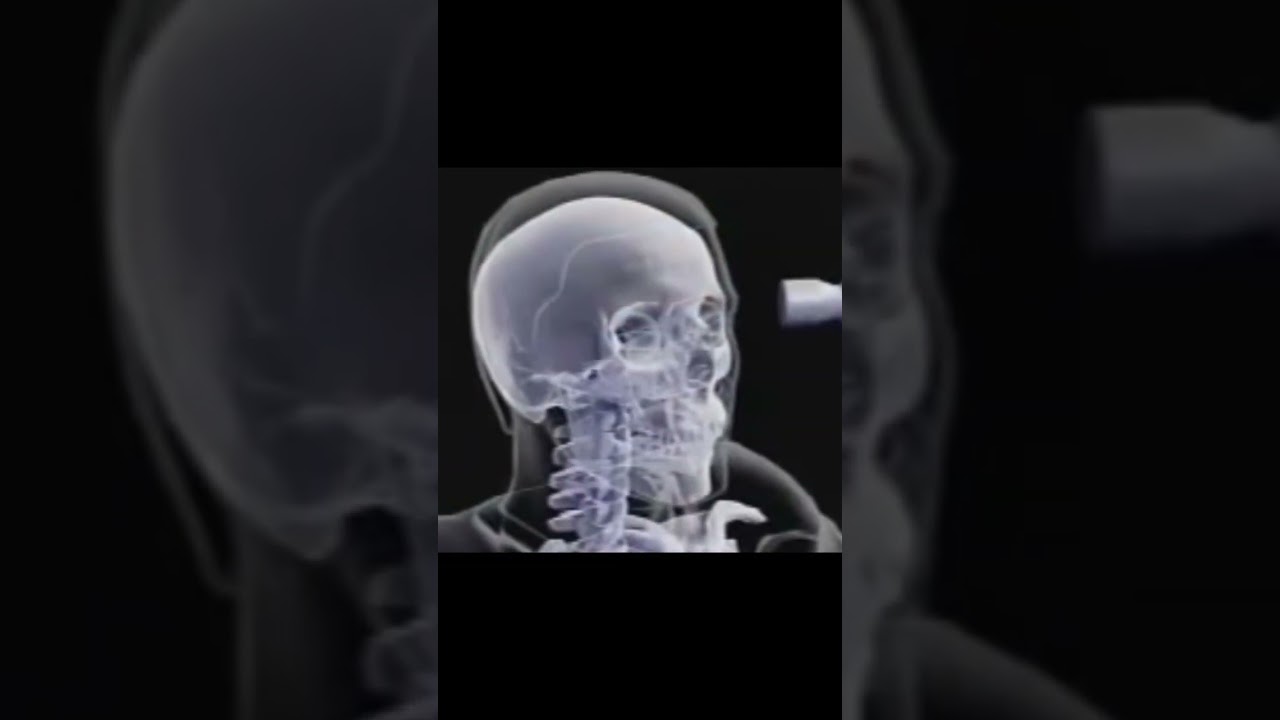 metal bat (roblox the strongest battlegrounds)