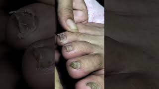 #pedicure #shorts