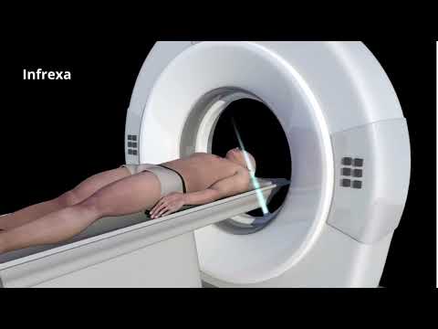 PET-CT Scan |  Lung cancer symptoms diagnosis - M3 | Infrex India