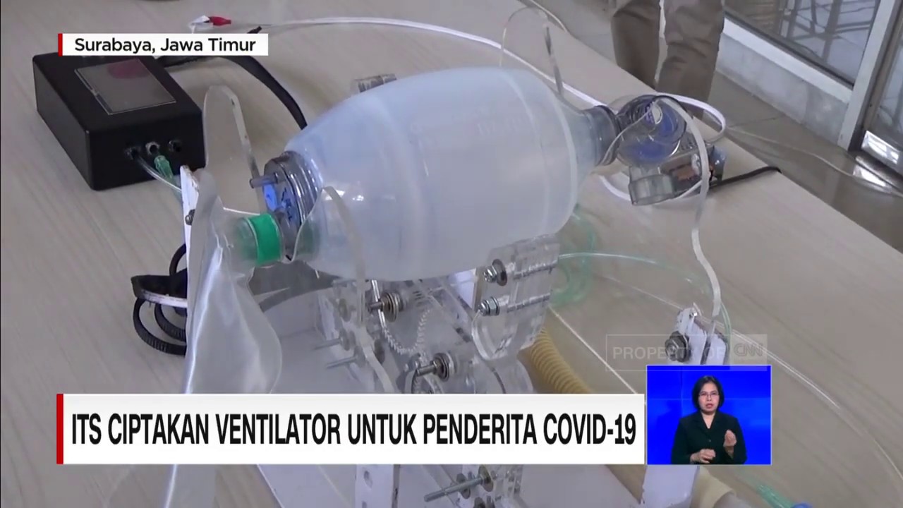 Ventilator mesin Ventilator ICU