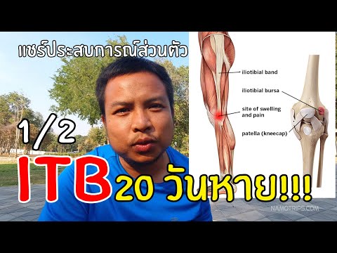 นักวิ่งเจ็บ ITB ฟื้นฟูยังไง ให้กลับมาวิ่งได้อย่างมีความสุขอีกครั้ง 1/2