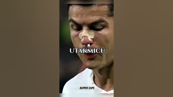 Cristiano Ronaldo Sudar Koji Mu Je Slomio Nos!#cristianoronaldo #cr7 #ronaldo #shorts #football