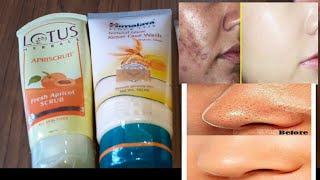 |Face wash and scrub review for flipkart| products review|prgativikash beauty|