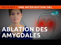 Information patient  ablation des amygdales palatines