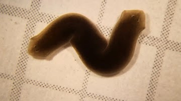 "What the physiological software of life means for patient-specific interventions" by Michael Levin