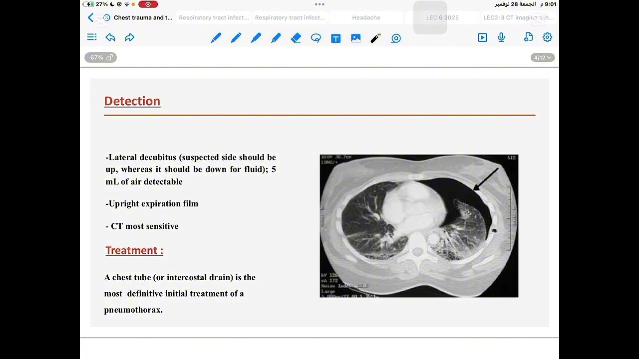 باطنية محاضرة 4 جزء 2