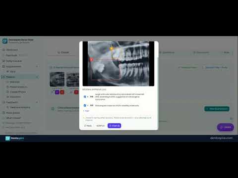 Watch AI highlight areas on a real dental X-ray