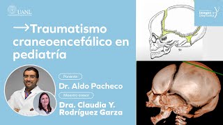 Traumatismo craneoencefálico en pediatría por le Dr. Aldo Pacheco.