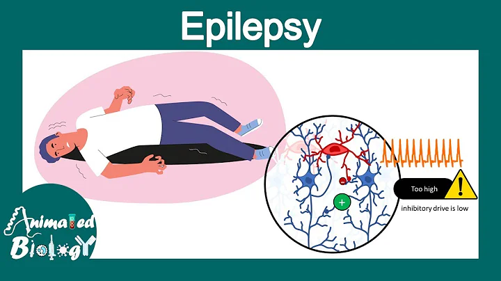Epilepsy & Seizure Disorder | Clinical Presentation | Biological mechanism | USMLE step 1