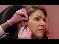 Sculptra Collagen Reproduction Treatment at Viva Vitality Medspa